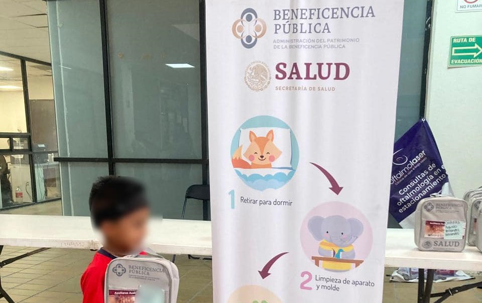 Niño de Villaflores es beneficiado con valerina ósea y auxiliares auditivos