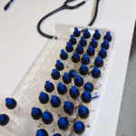 En el Día Mundial de la Alergia, ISSSTE llama a atender síntomas y evitar complicaciones